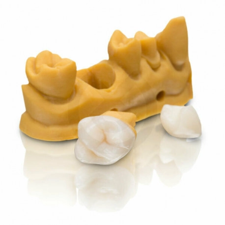 VarseoSmile Crown Plus